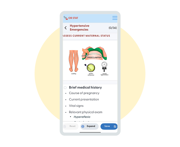 Mockup image of OB Stat App