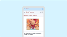 Umbilical Cord Prolapse